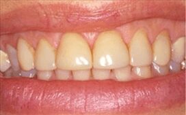 Pheinix-dentist-before