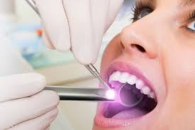 oral cancer screening Surprise