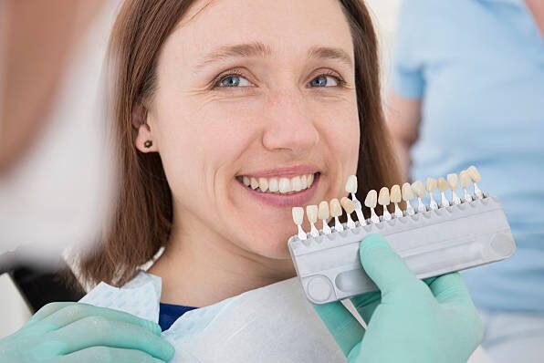 veneers in phoenix AZ